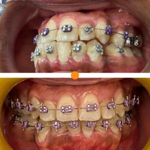 155363568_260739455619039_2048906572389688247_n