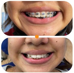 Dental palmar ortodoncia_10