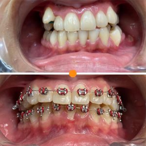 Dental palmar ortodoncia_11