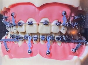 Dental palmar ortodoncia_12