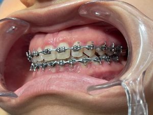 Dental palmar ortodoncia_6