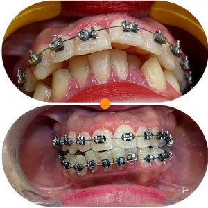 Dental palmar ortodoncia_7