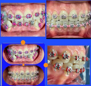 Dental palmar ortodoncia_9