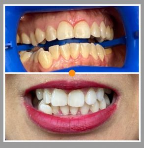 WhatsApp Image 2022-03-15 at 10.04.20 AM (1)